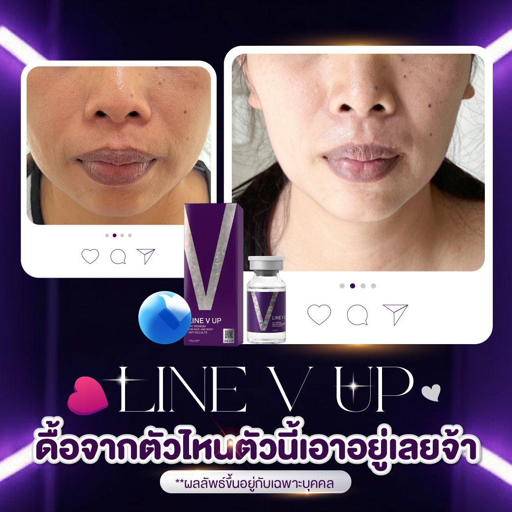 LINE V UP - Image 8