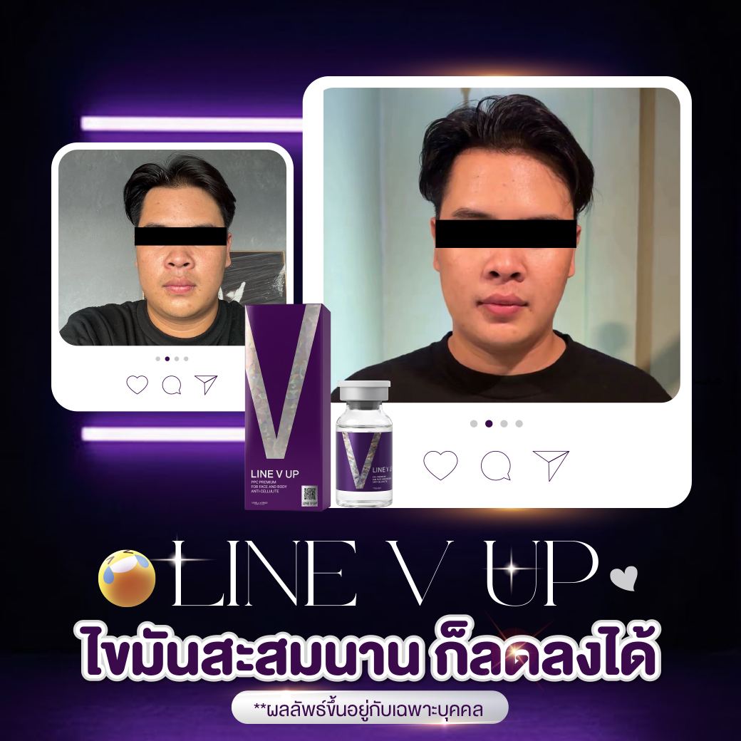 LINE V UP - Image 7