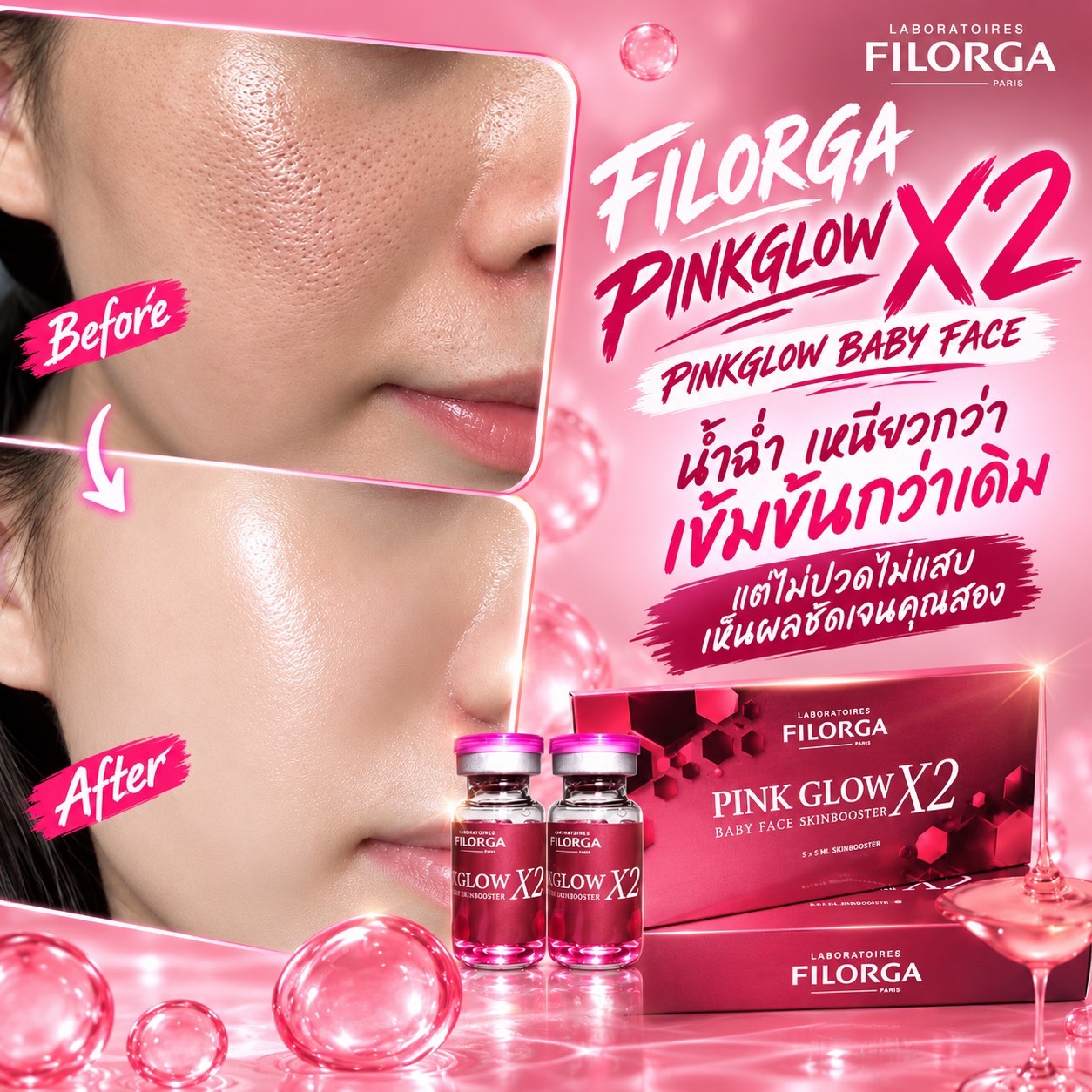 FILORGA PINKGLOW X2 BABY FACE SKINBOOSTER - Image 22
